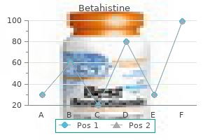 16 mg betahistine buy overnight delivery