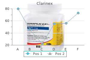 quality clarinex 5 mg