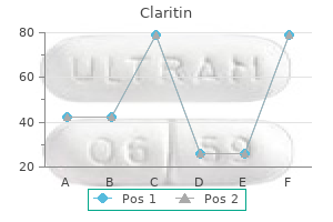 claritin 10 mg discount free shipping