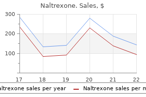 naltrexone 50 mg buy mastercard