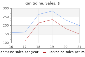 ranitidine 300 mg generic on-line