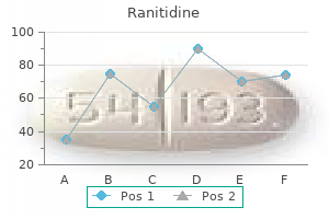 ranitidine 300 mg buy line