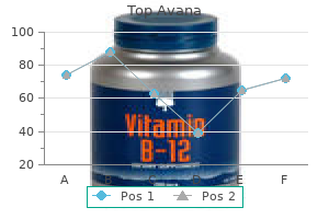 discount top avana 80 mg fast delivery