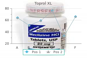 order toprol xl 25 mg free shipping