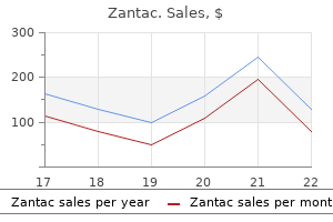 150 mg zantac with amex