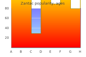 zantac 150 mg buy discount