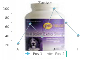 cheap 150 mg zantac fast delivery