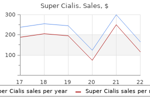 buy 80mg super cialis visa