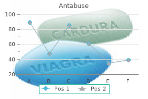 discount 500mg antabuse fast delivery