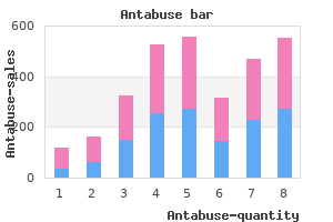 quality 500 mg antabuse