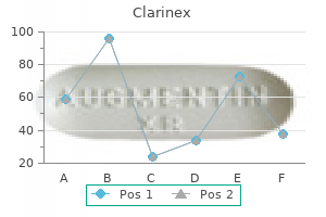 generic 5 mg clarinex mastercard