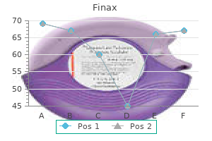 generic finax 1 mg line