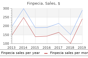 buy finpecia 1mg fast delivery