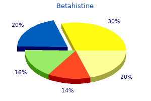 best 16 mg betahistine
