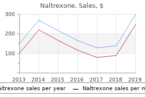 purchase naltrexone 50 mg free shipping