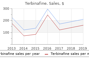cheap terbinafine 250mg overnight delivery