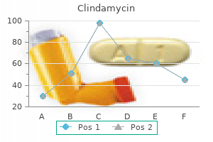 buy clindamycin 150 mg lowest price